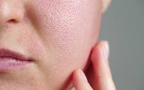 Skin Pores